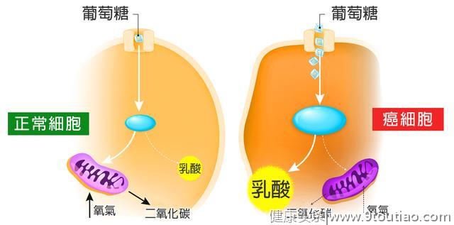 少吃这5种含糖食物，正常人吃过量的糖会促发癌症