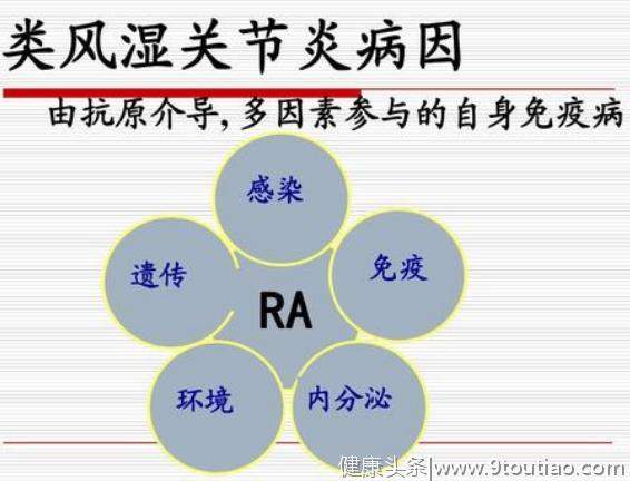 揭秘：类风湿因子呈阳性就一定得了类风湿吗？