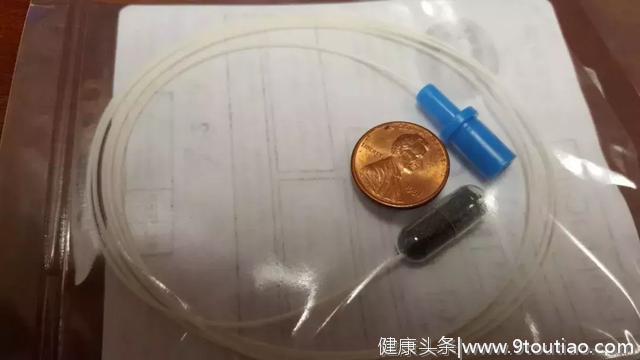 一颗小胶囊就能检测,这种癌症中国发病率全球最高!