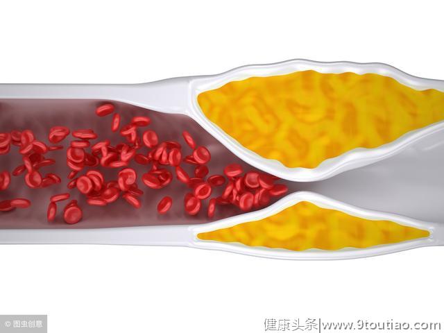 40岁以后，人到中年，吃什么才能清理血管垃圾？医生这次说明白！