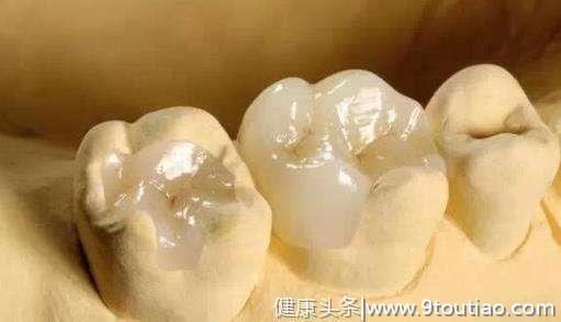 虫牙就是牙里长虫吗？为什么到疼痛后才会发现？