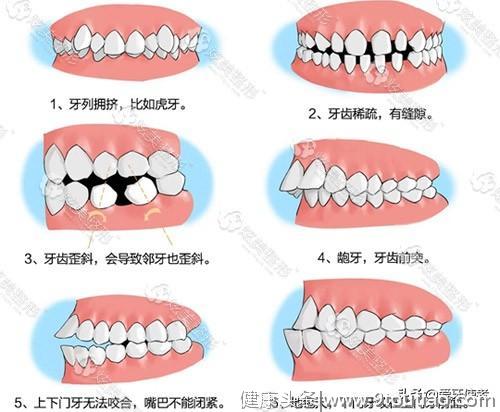 牙齿矫正的流程是什么？
