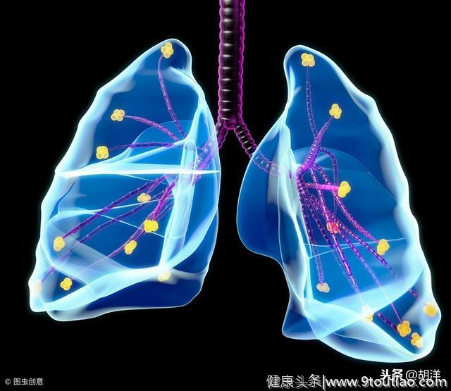 被称为不是肺癌的肺癌，无法治愈的肺病之一，著名演员因它去世