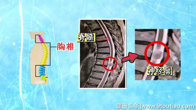 疼痛、麻木、发冷？医生：跟我学缓解颈椎锻炼方法和腰椎锻炼方法