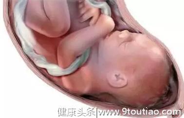 怀孕期间害怕胎儿“脐带绕颈”，这些原因要搞清，做好预防是关键
