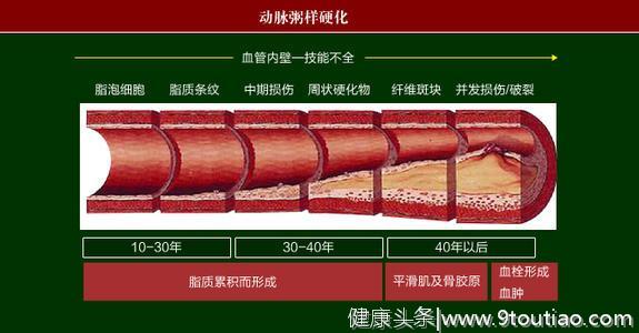 注意口腔卫生，研究发现儿童口腔感染与成年动脉粥样硬化风险有关