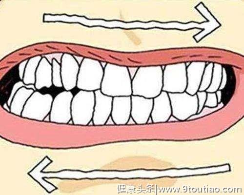 有Q就能种牙？牙医告诉你，这些人不宜做种植牙修复！
