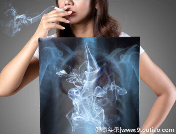 肺癌不是男人的专利：女性不吸烟人群也可能被盯上，做好4点预防