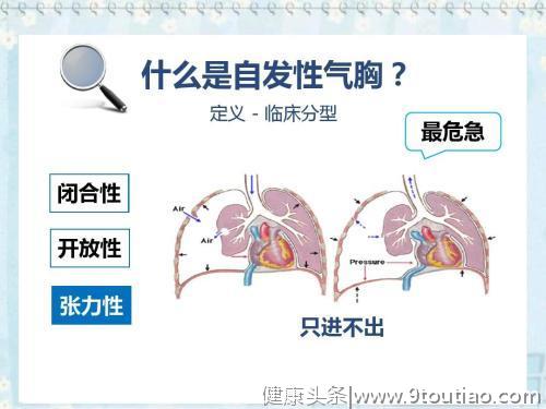 胸痛未必都是冠心病，但是同样不能耽搁