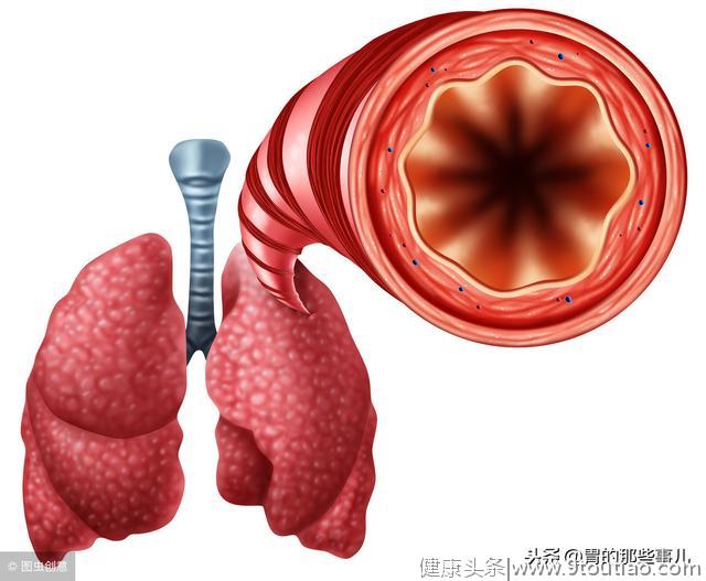 去看病说是胃源性哮喘？胃源性哮喘应该怎么办？