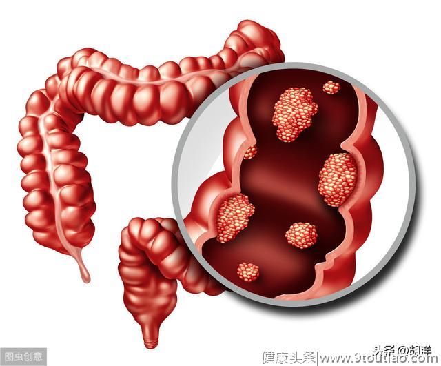 小伙迷信验血，甲胎蛋白未升高以为不会得肝癌，三个月后肝癌晚期