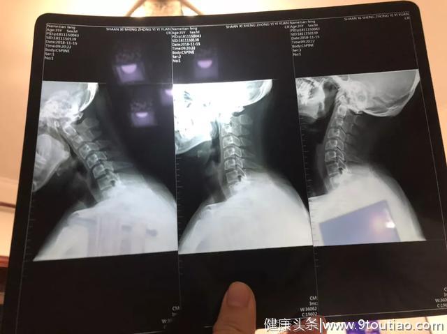 给孩子报各种培训班的家长注意了别忘了保护孩子颈椎