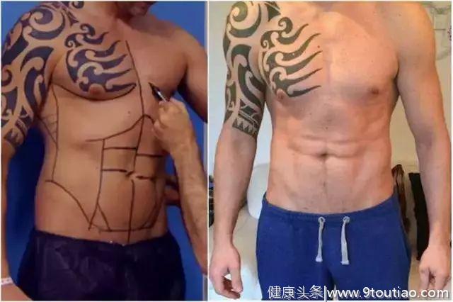泰国男子通过手术做了六块“人造腹肌”！背后真实面目你见过吗？
