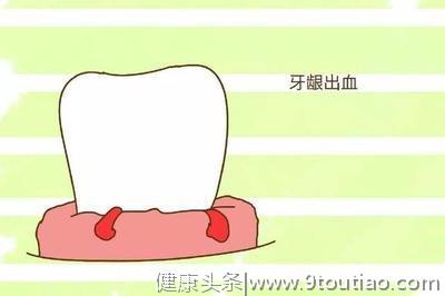只有牙疼才需要去看医生?专家程涛：这几个口腔问题，千万别忽视!