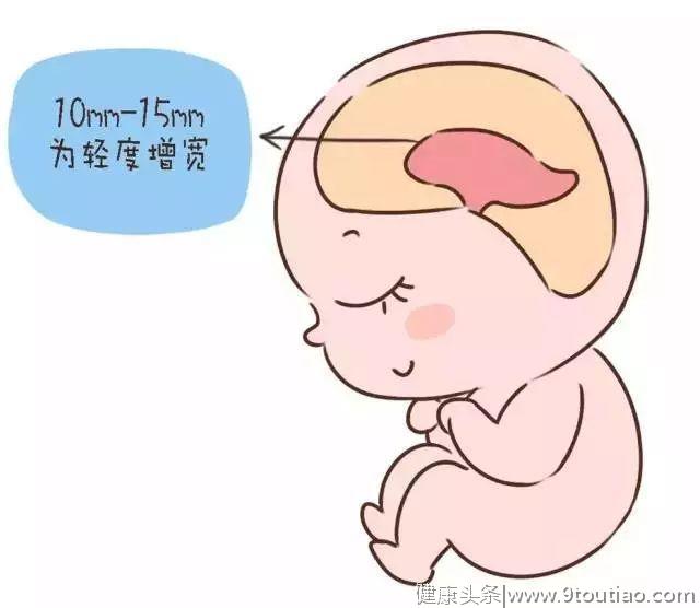 怀孕8个月产检，医生说胎儿头大身体小，孕妇搞清背后4个含义