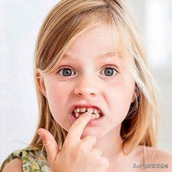 孩子为什么会牙齿不齐？