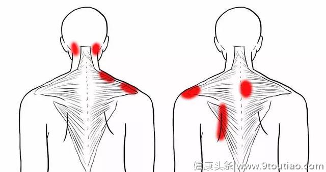 10张精准拉伸解剖图，“肩颈疼痛”这样练就对了！