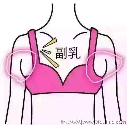 “副乳”别轻视，可能是乳腺癌、淋巴癌的前奏！