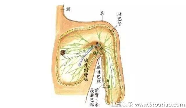 “副乳”别轻视，可能是乳腺癌、淋巴癌的前奏！