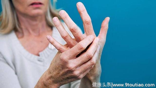 类风湿性关节炎症状：你的手是这种感觉么？如果是，请小心！