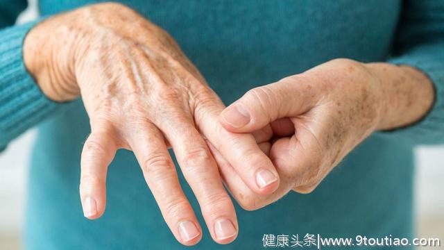 类风湿性关节炎症状：你的手是这种感觉么？如果是，请小心！