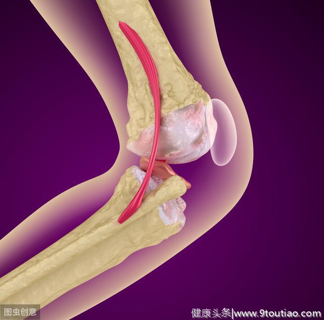得了骨关节炎，可能手术都治不好？这6点误区早知道避免疼痛！
