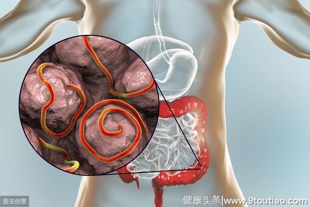 26岁男子，肠癌住院，医生怒斥：成年人了一张嘴都控制不住？