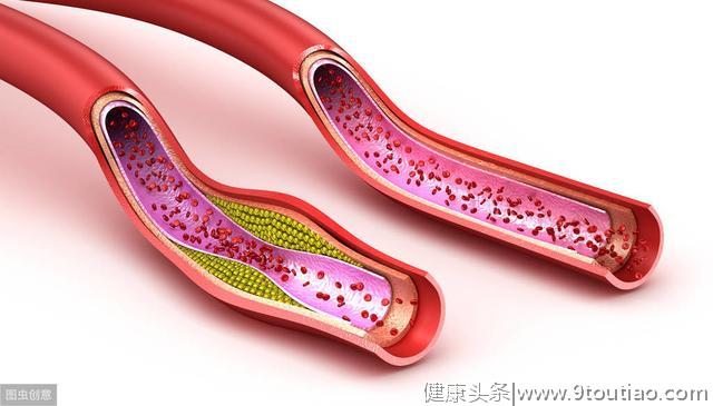 被国人所迷恋的养生保健项目，实则是一个不折不扣的大骗局