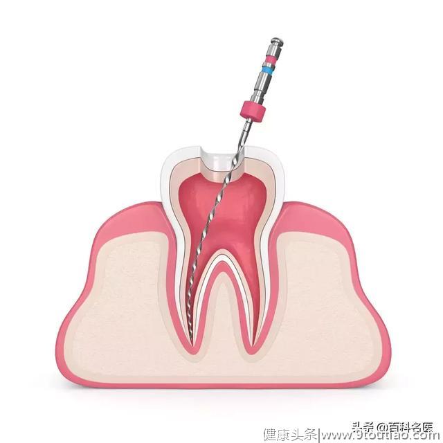 牙齿上的小黑点为啥抠不掉？今天告诉你真相