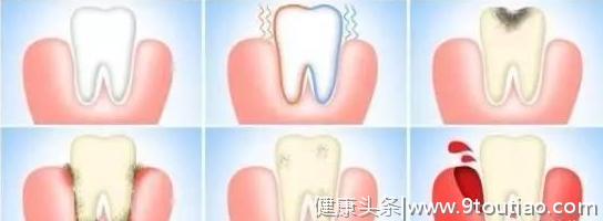 牙齿牵连的身体健康状况~