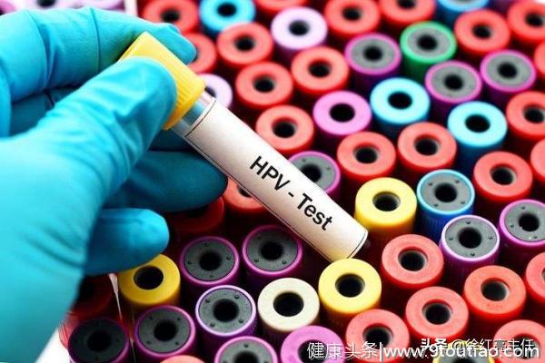 宫颈癌的罪魁祸首——HPV（人乳头瘤病毒）