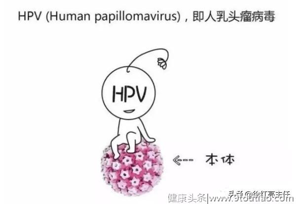 宫颈癌的罪魁祸首——HPV（人乳头瘤病毒）