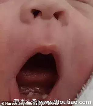 真·骨骼清奇，英国一婴儿居然一出生就有牙齿