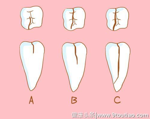牙齿看起来没有什么问题， 但却疼的厉害是什么原因导致的？
