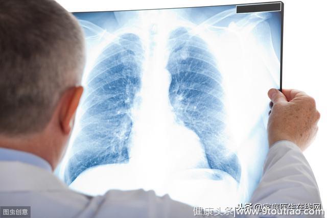4个异常你都有，肺可能已经不健康了，快去筛查肺癌