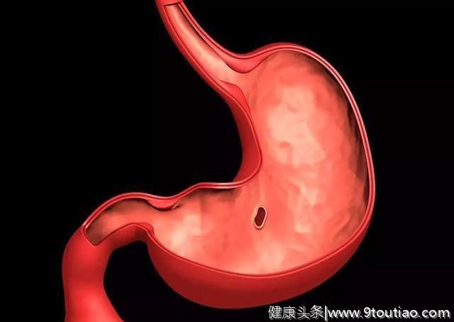 32岁女子查出胃癌晚期，提醒：常吃3种“菜”，会让胃肠受不了！