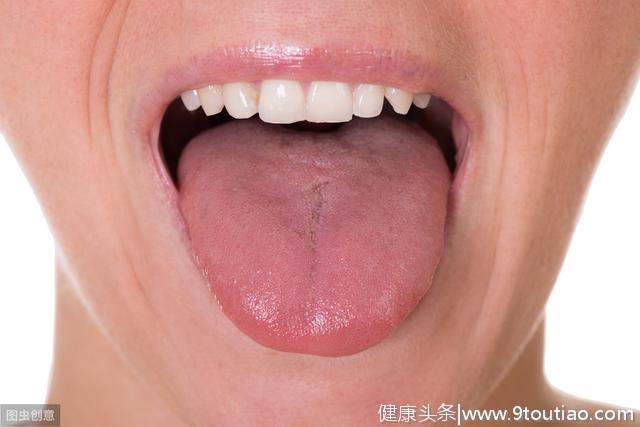 无论男女 嘴里出现3个“迹象” 你或许已经向“胃癌”迈进