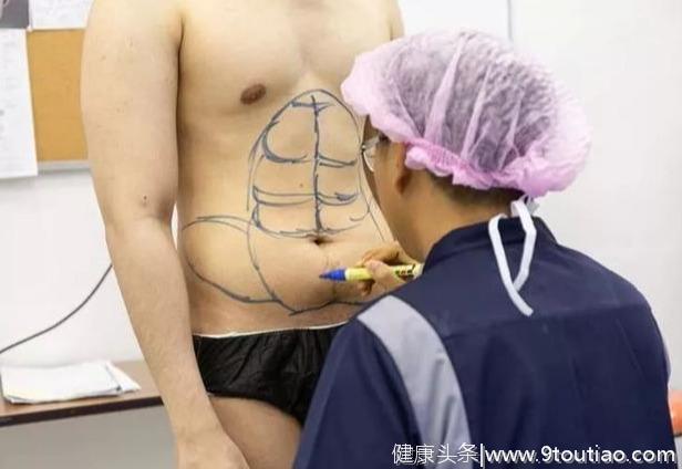 泰国男网红做手术“整出”6块腹肌