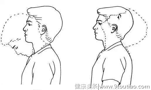 骨科医生告诉你，颈椎前路手术后要注意什么？