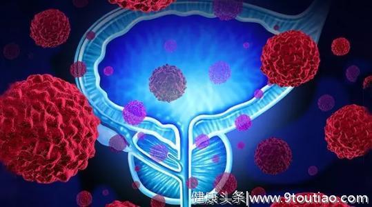 中国41万人研究：2型糖尿病与几种癌症风险高有关，要尽早防控。
