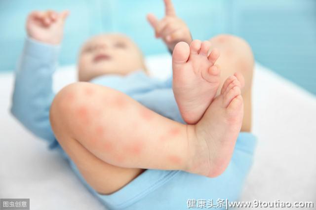 中医科普：小儿常见过敏性疾病的预防诊断和治疗