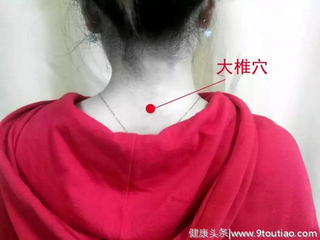 中国中医科学院门诊部：8个方法教你消除富贵包 附艾灸方法