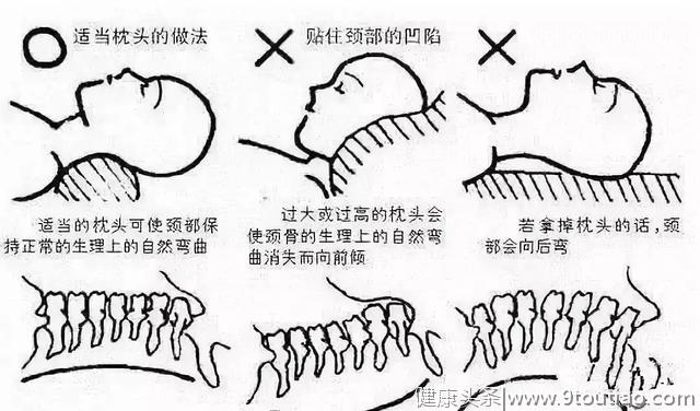 中国中医科学院门诊部：8个方法教你消除富贵包 附艾灸方法