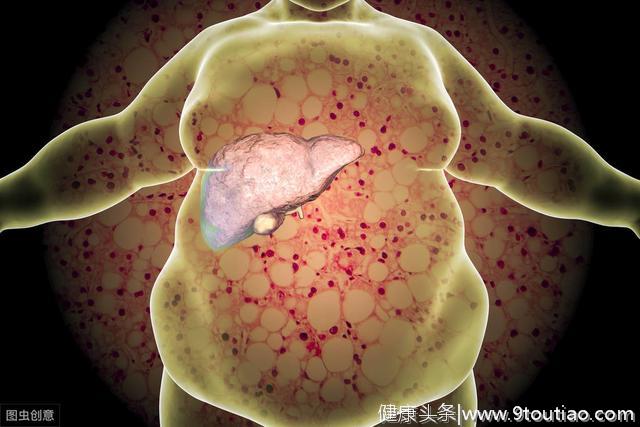 脂肪肝是怎样炼成的？医生提醒千万不能小瞧它！