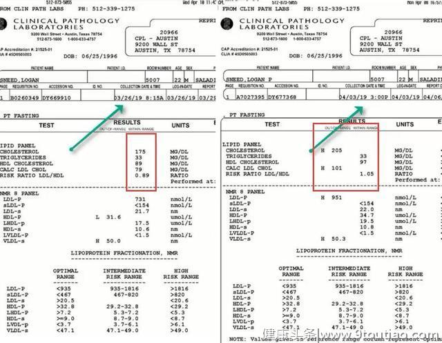 健身不能吃蛋黄？肌肉男7天吃84个整鸡蛋，看身材和胆固醇变化