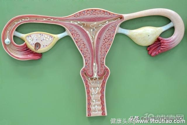 得了子宫肌瘤，为啥要切除子宫？明明有4种保宫方法