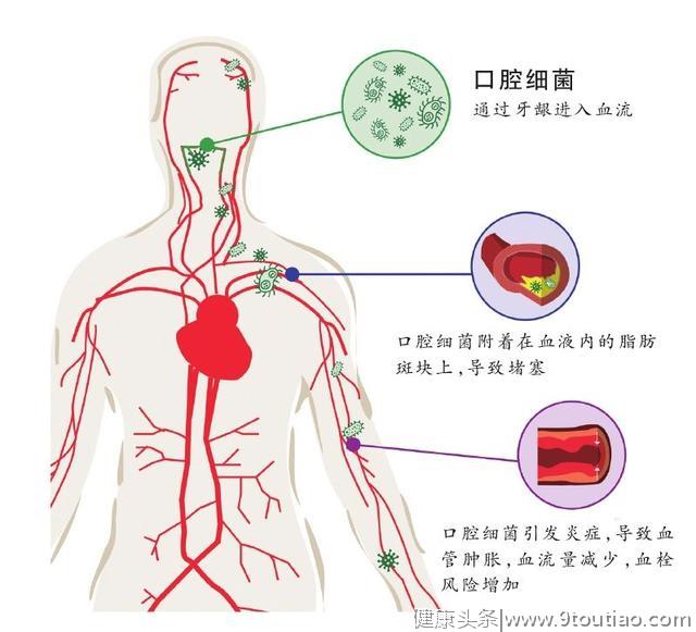 心口相联，每天多刷一次牙能预防心血管病！