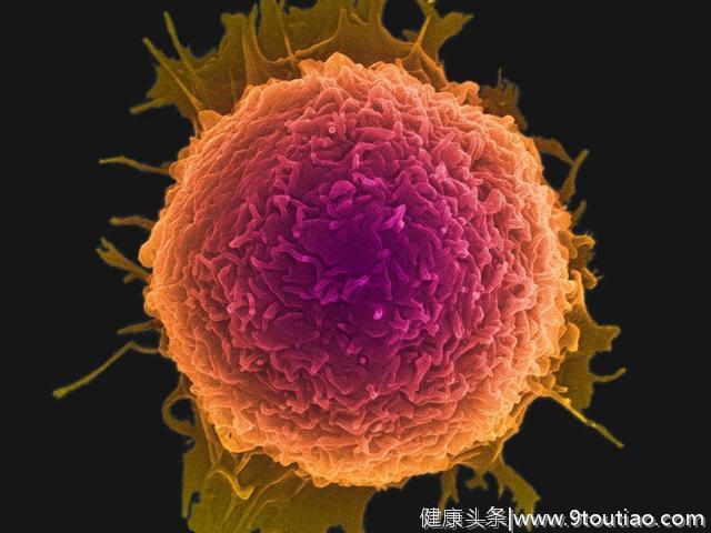 癌细胞也有软肋？科学家锁定肿瘤干细胞，治愈癌症并非没有可能！