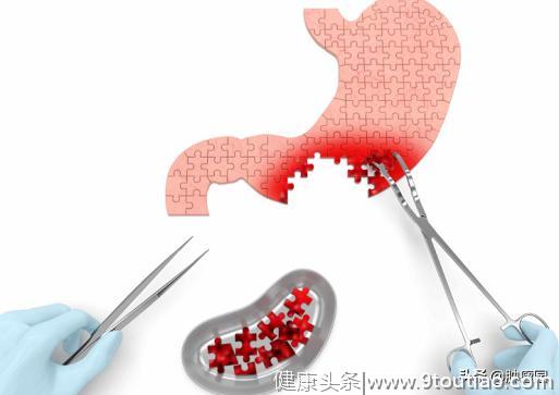 胃癌发现多半是晚期，若身体出现这6大信号，小心胃癌正在靠近!