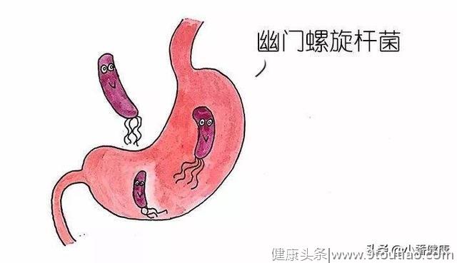 幽门螺杆菌致胃癌 消瘦恶心上腹部饱胀 除胃镜还需筛查HP